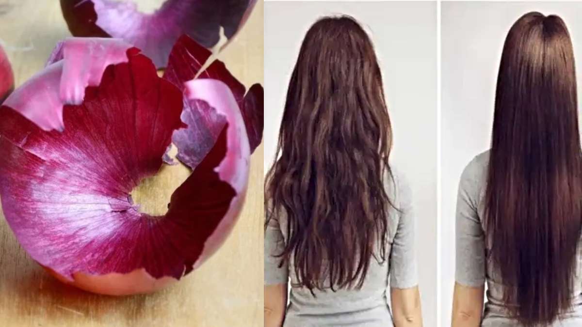 Hair Care Tips: प्याज के छिलकों को बेकार समझकर न फेंकें, बालों के लिए हैं बेहद फायदेमंद