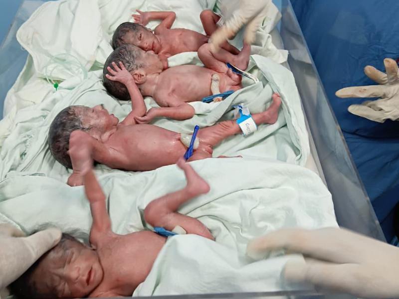 एक साथ दिया 4 बच्चों को जन्म ! महाराष्ट्र में सामने आया हैरान करने वाला मामला ; पहले भी जुड़वा बच्चों को दे चुकी है जन्म, काजल बनी कुल 7 बच्चों की मां