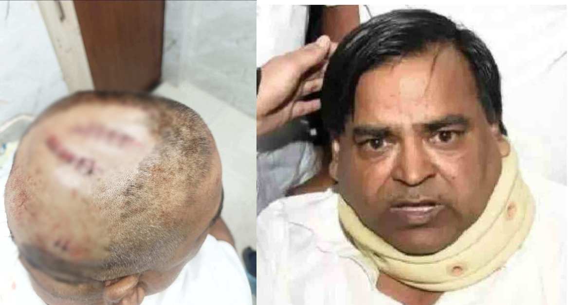कौन था वो कैदी? पूर्व मंत्री गायत्री प्रसाद प्रजापति पर हमला करने वाले की पहचान नहीं बता रही पुलिस, 3 जगहों पर लगे हैं टांके