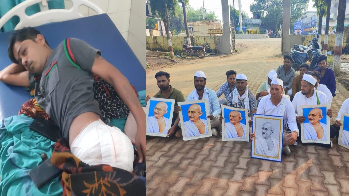 थाना प्रभारी पर बर्बरता का आरोप, लात मारने से आदिवासी युवक के कूल्हे में फूटी शराब की बोतल, घायल का इलाज जारी