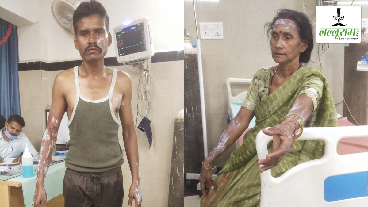 देर रात मंदिर खोलने को लेकर विवाद, आरोपी ने मां-बेटे पर फेंका उबलता तेल, दोनों गंभीर रूप से झुलसे, इलाके में तनाव का माहौल