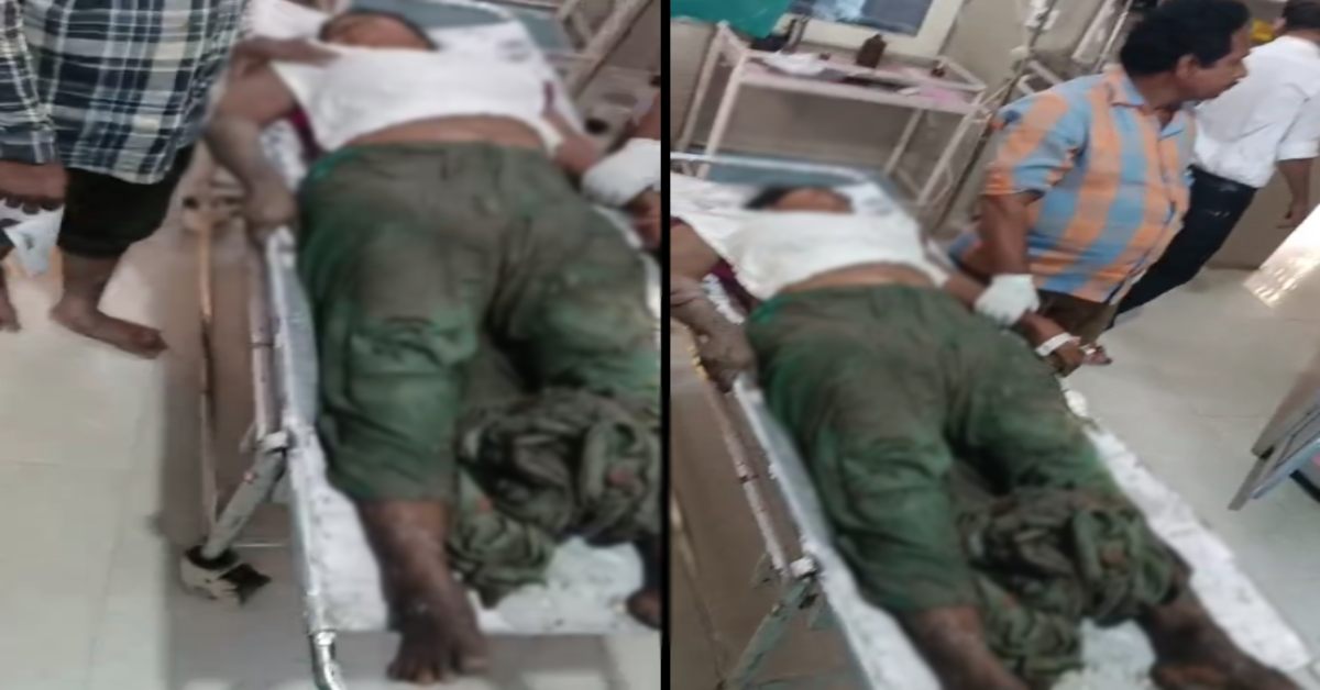 पेटीकोट का नाड़ा तोड़ा और… MP के राजगढ़ में चाचा बना हैवान, पहले भतीजी के साथ किया ऐसा काम, फिर फेंका तेजाब, गंभीर रूप से झुलसी, पुलिस पर गंभीर आरोप
