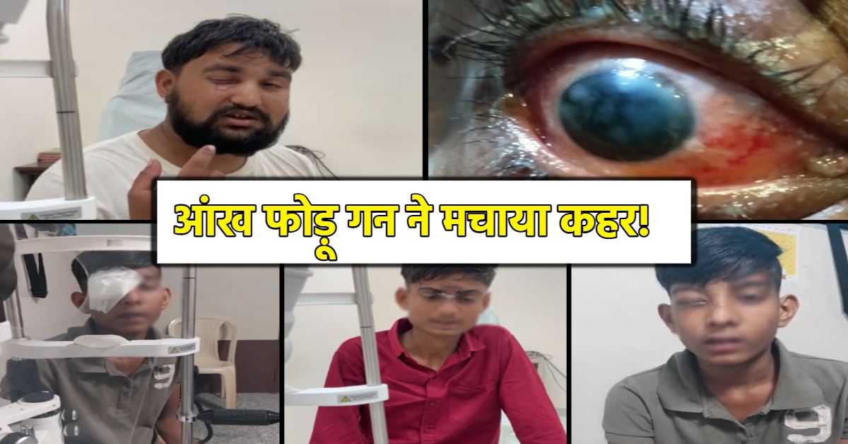 रोशनी के पर्व में लापरवाही से छाया जीवन में अंधेरा! कहर बनकर टूटी देसी जुगाड़ से बनी कार्बाइड गन, 200 से ज्यादा लोगों की आंखों को पहुंचाया नुकसान