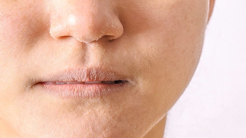 Diet For Dry Skin