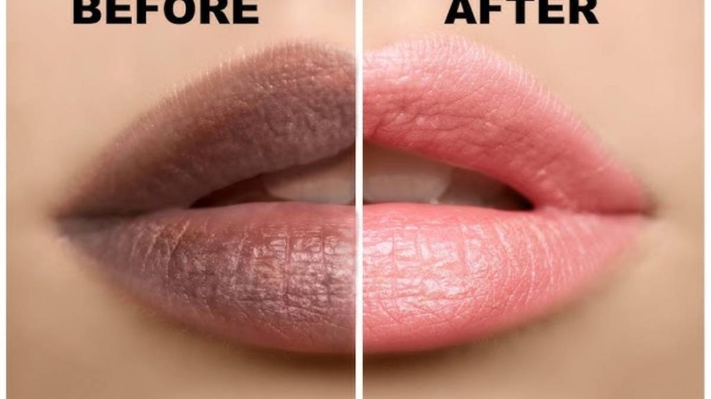 Home Remedies for Dark Lips in Winter