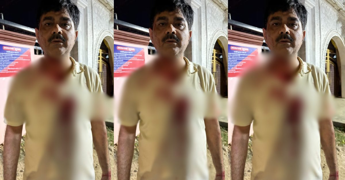 BREAKING : डिप्टी सीएम के कार्यालय में तैनात अधिकारी पर जानलेवा हमला, दबंगों ने किया लहूलुहान