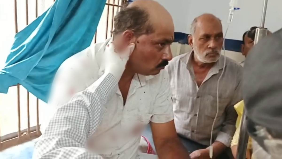 नगर परिषद अध्यक्ष के पति पर फायरिंग, हमलावर फरार गंभीर हालत में सतना रेफर
