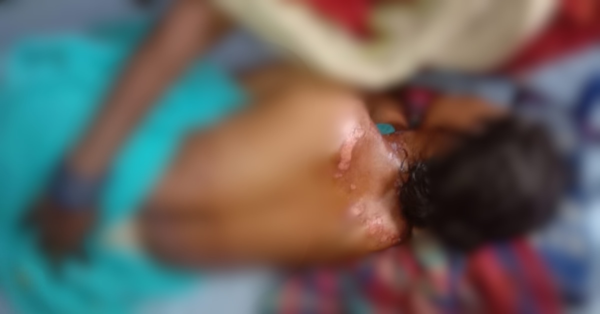 Umaria News: घर पर सो रही थी विधवा, अंदर घुसकर की ऐसी हरकत कि शरीर पर पड़ गए घाव, महिला की चीख सुन सन्न रह गए ग्रामीण
