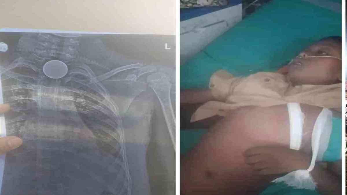 CG News : गले में सिक्का फंसने से मासूम की मौत, परिवार में पसरा मातम